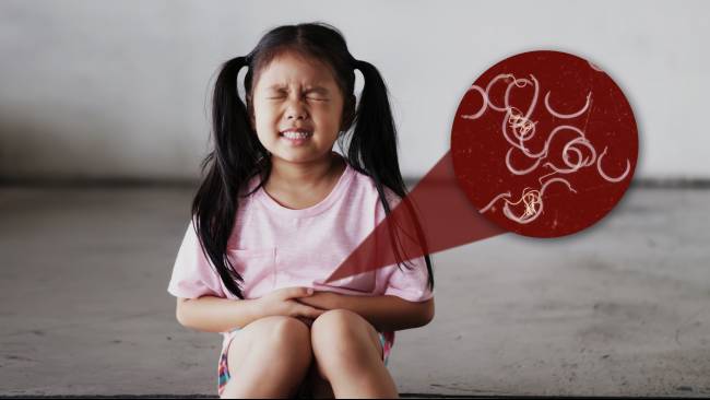 Bahaya Tersembunyi: Dampak Serius Infeksi Cacing pada Pertumbuhan Anak