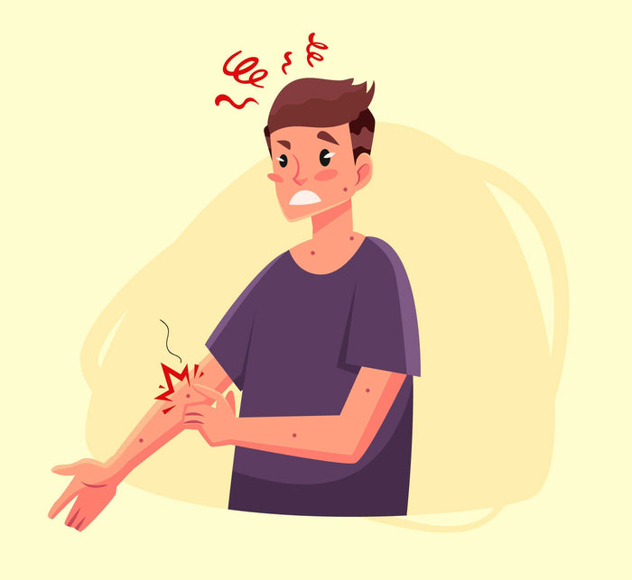Ketahui Tentang Penyakit Dermatitis Atopik (Eksim) - Menteng Farma