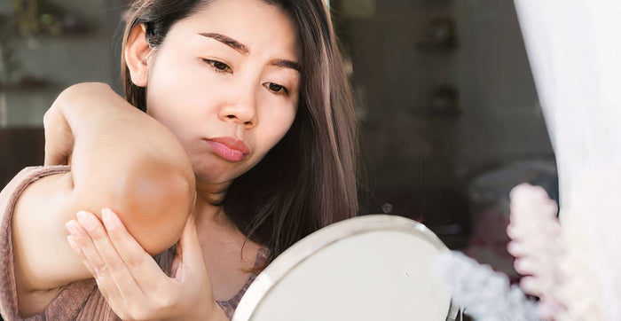 Cara Alami Menyamarkan Bagian Tubuh yang Gelap