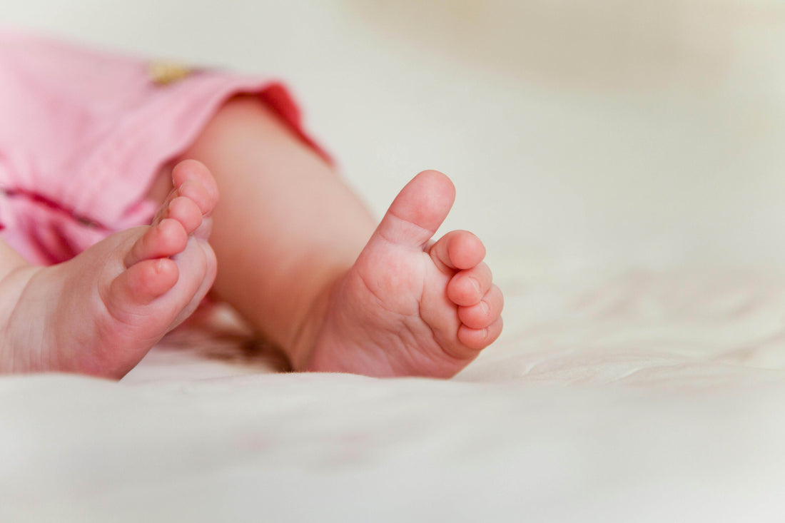 Polidaktili pada Bayi dan Anak: Perlukah Operasi?