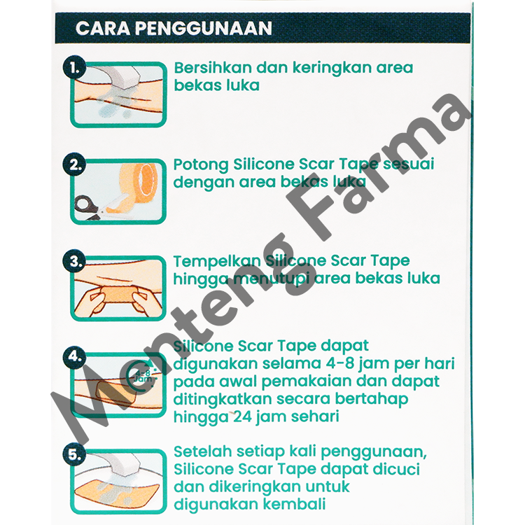 Mandjur Silicone Scar Tape 4cm x 150cm - Plester penghilang bekas luka keloid