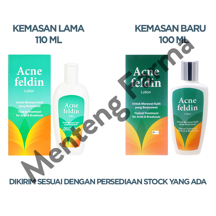 Acne Feldin Lotion - Lotion Perawatan Kulit Berjerawat