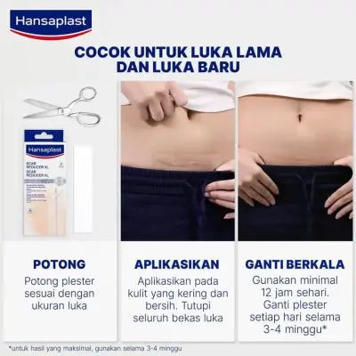 Hansaplast Plester Bekas Luka XL isi 21 Lembar - Menghilangkan Bekas Luka & Keloid